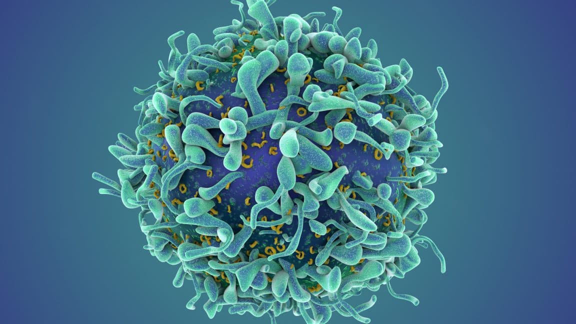 CAR T Cell Therapy Could Be a Game-Changer for Autoimmune Disease