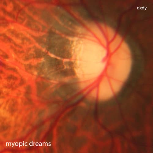 Myopic Dreams
